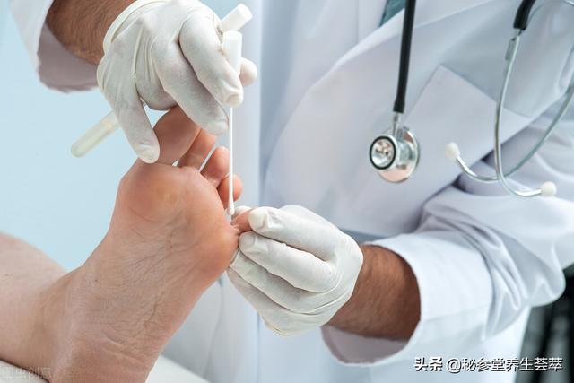 甲沟炎和甲下脓肿怎么治疗，甲沟炎和甲下脓肿怎么治疗好（甲沟炎有脓怎么排脓）