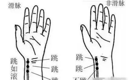 28种脉完全图解，如何把脉看怀孕（中医把脉歌诀----郎朗上口）