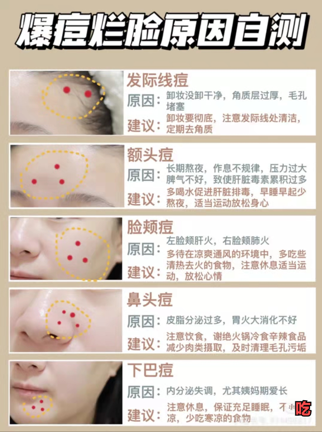 脸颊两边反复长痘痘怎么调理，脸颊老长痘痘怎么办（做好这几点想不祛都难）