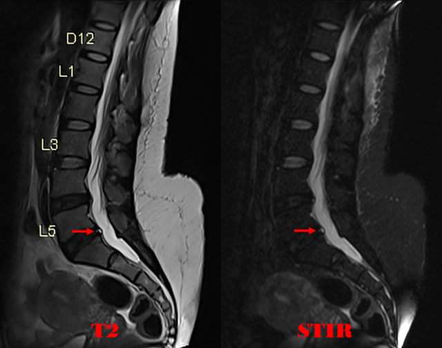 医学名词解释，医学名词解释app（医学名词—HIZ）