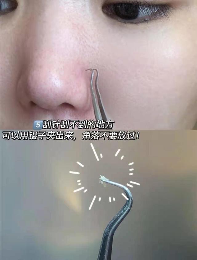 去黑头收缩毛孔，怎样去黑头和收缩毛孔（去黑头收缩毛孔的最好方法）