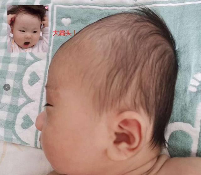 婴儿肥和圆脸的区别图片