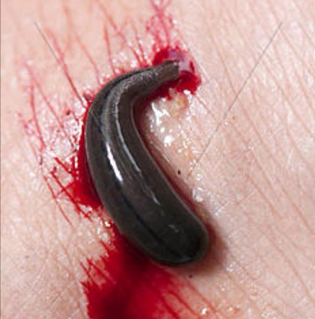 怀孕梦见蚂蝗是什么意思，孕妇做梦梦到蚂蝗是什么征兆（梦到好多蚂蟥）