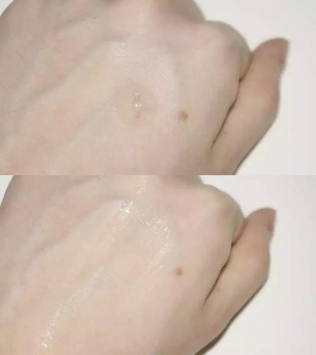 哪里有打美白针的，选对美白精华就能稳赢（哪里有美白针可以打）