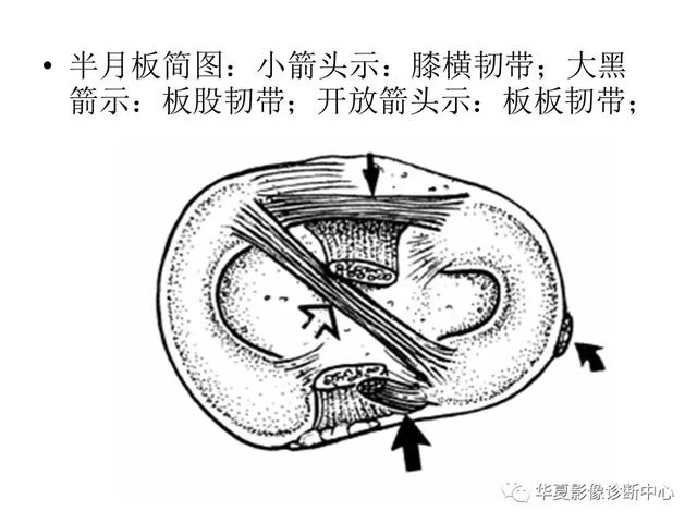 膝关节解剖结构图，膝盖解剖图示意图（膝关节MRI之正常解剖综述）