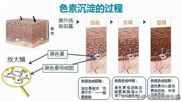 斑是怎么形成的?有几种原因，斑是怎么形成的有几种原因（好好的皮肤为什么会长斑）