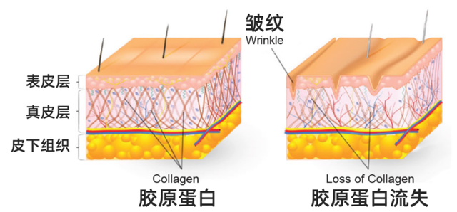 胶原肽是什么（胶原蛋白是“智商税”吗）