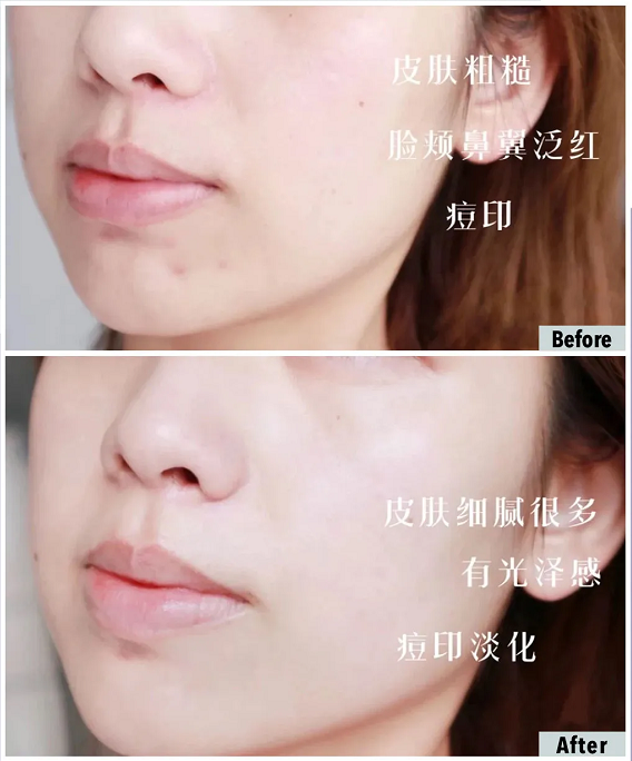 十滴水洗脸的用法，十滴水洗脸的用法与用量（还是十滴水比较方便）