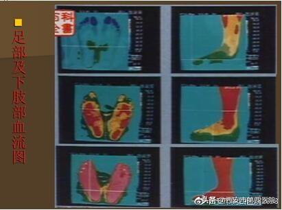 脚部反射区的自我疗法，足部反射区疗法《常用手法》《1》（足部反射区按摩）