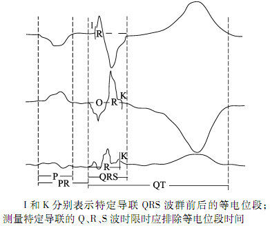 qtc间期正常值，心电图qt和qtc间期正常是多少毫秒