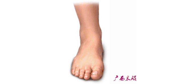 崴了脚怎么办, 崴脚></p></a>不当一回事(脚崴到了怎么办怎么快速恢复)