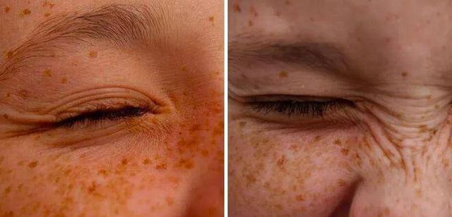 lumene面膜怎么样，ruynesse面膜怎么样（能掐出水的少女肌肤）