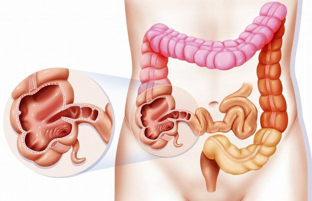 肥肠是哪个部位（你知道我们有哪些“肠”吗）