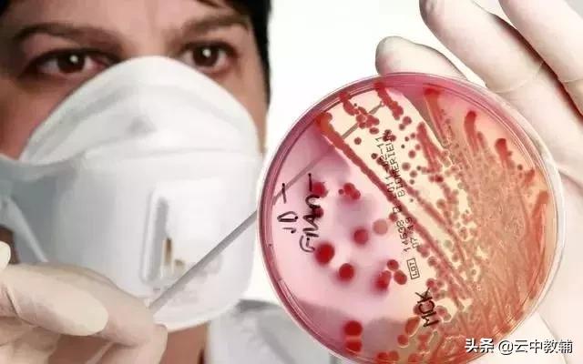 大肠杆菌菌落特征，大肠杆菌培养（一位高中生物老师分享对生物的理解）