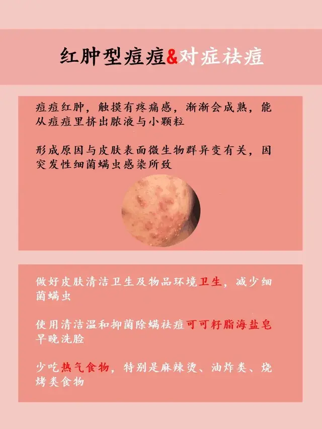 碘伏可以涂在脸上的痘痘吗，碘伏消毒液可以涂脸上痘痘吗（5种不同类型得痘痘）