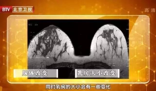女生塑形篇——如何消除腋下的赘肉！，减掉腋下赘肉的动作（可能是副乳在作祟，还可能癌变）