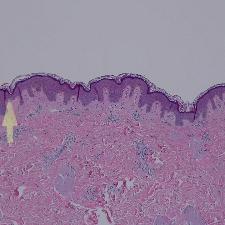 我们将从医学切片的角度来详细认知一下真实的皮肤结构和功能,为我们