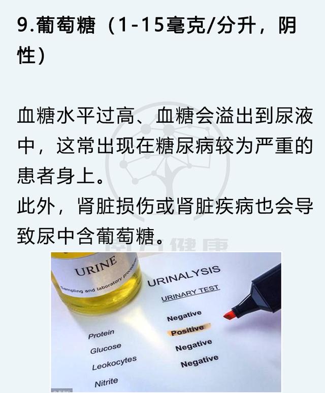 尿常规怎么检查，男性尿常规怎么看（5分钟判断身体健康）
