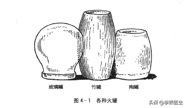 拔火罐的方法，正确拔火罐教程（拔罐法全面解读）