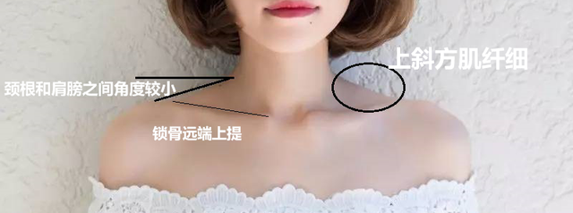 溜肩怎么练成平肩，男生溜肩怎么练成平肩（上斜方肌受着不可承受之重。选对方法）