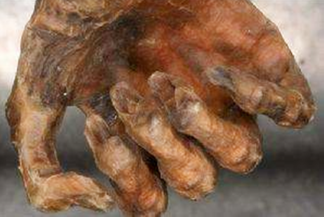 木乃伊是怎么形成的，木乃伊是怎么形成的图片（跟他有过接触的人都死了）