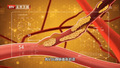 如何判断水肿体质，如何判断水肿体质的原因（3个问题体质）