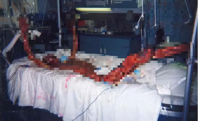 日本东海村核临界事故，日本东海村核临界事故百科（核辐射惨烈堪比十八层地狱）