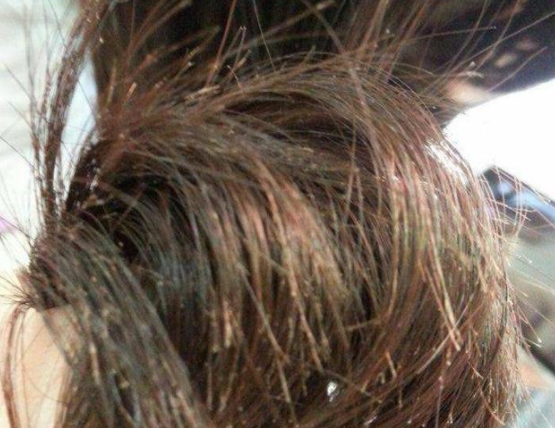 小妙招让头发立刻柔顺不干枯，怎样保养头发又黑又顺（洗头时注意这2点）