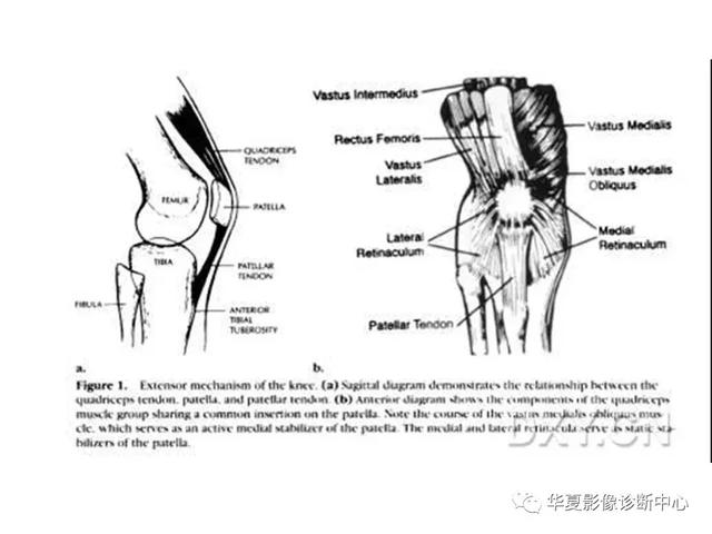 膝关节解剖结构图，膝盖解剖图示意图（膝关节MRI之正常解剖综述）