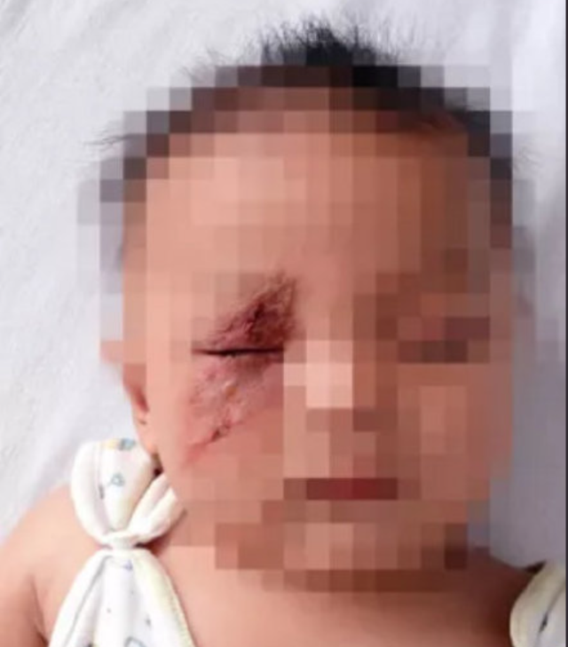 隐翅虫在床上爬了还能睡吗，家里为什么会有隐翅虫（妈妈用3分钟处理法救了娃）