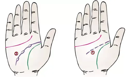 掌纹诊病实用图谱，看看你的掌纹：预示者不同疾病（可以诊断肝癌、糖尿病、高血压、妇科病、脑溢血）