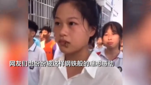 被黄蜂蛰了怎么办，孕妇被黄蜂蛰了怎么办（最正确的做法是什么）