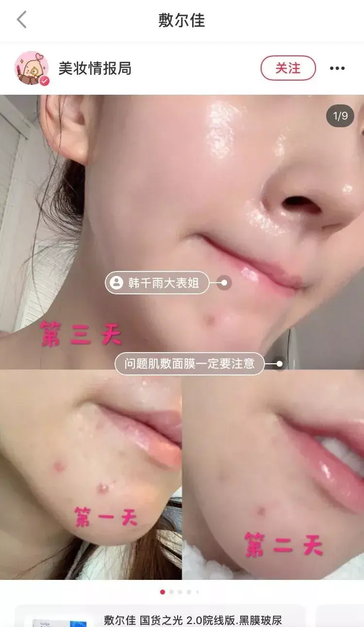敷尔佳面膜(保湿面膜哪个牌子最好)