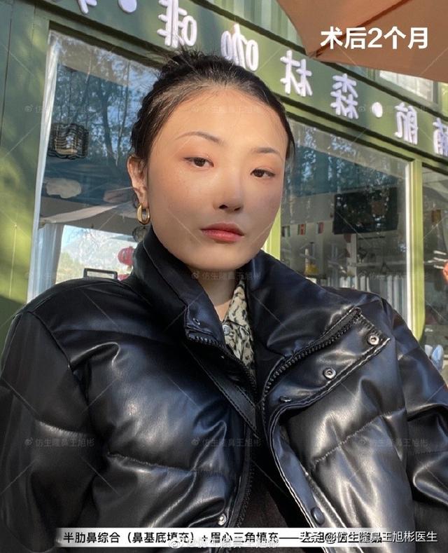 高级脸是什么意思，6种脸型不显老（“月亮脸”逆袭“高级脸”的不二法则是）