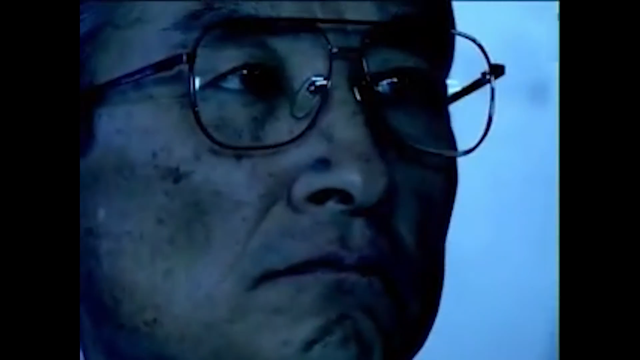 大内久83天活体腐烂图片，大内久83天活体腐烂是什么（大内久与核辐射战斗了83天）