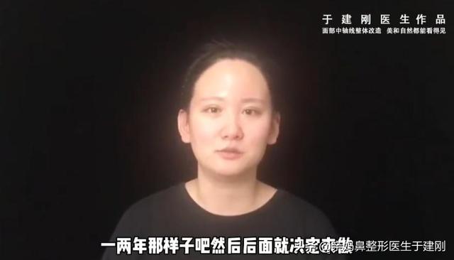 一张图看懂鼻基底凹陷对比图，塌鼻秒变立体质感鼻