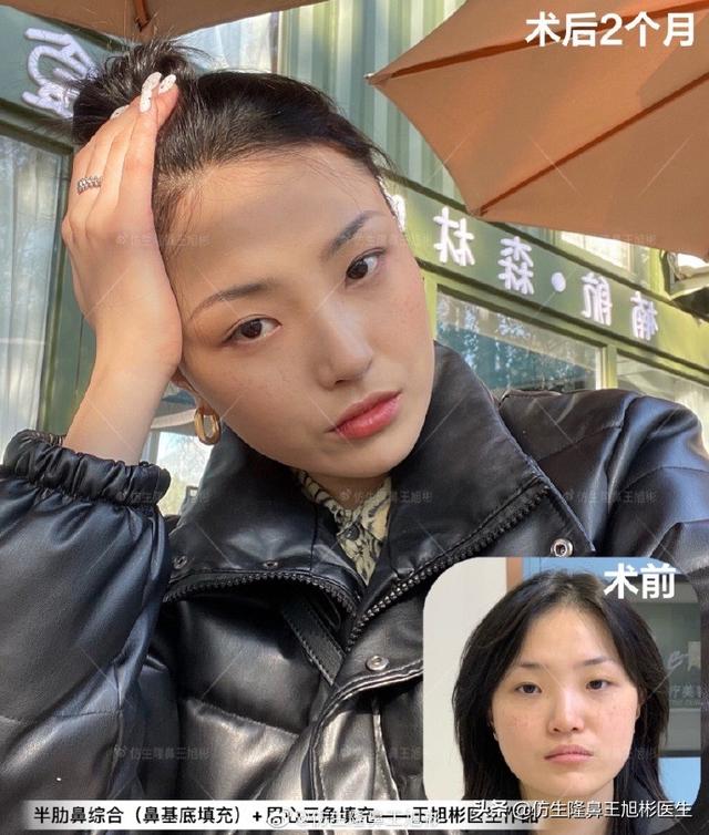 高级脸是什么意思，6种脸型不显老（“月亮脸”逆袭“高级脸”的不二法则是）