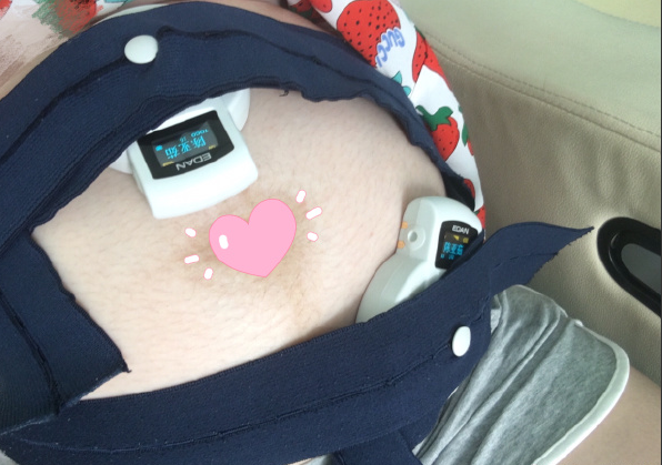 胎儿的心率多少是正常范围，怀孕胎心率多少是正常范围（胎心位置忽上忽下正常吗）