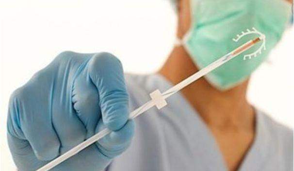 取环一个人去可以吗(节育器就一劳永逸) - 乐宝宝贝