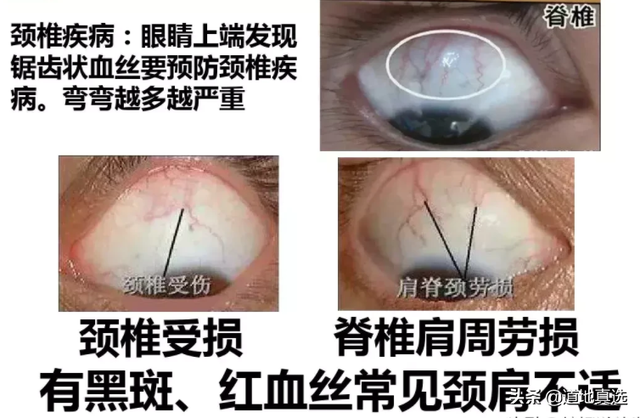 脸部各个部位名称叫什么，脸部位置名称图解（老中医面诊：从脸部五官看疾病）