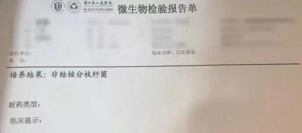 溶脂针瘦腿有什么危害，溶脂针瘦腿有什么危害吗（28岁女子打“瘦腿针”后险遭截肢）