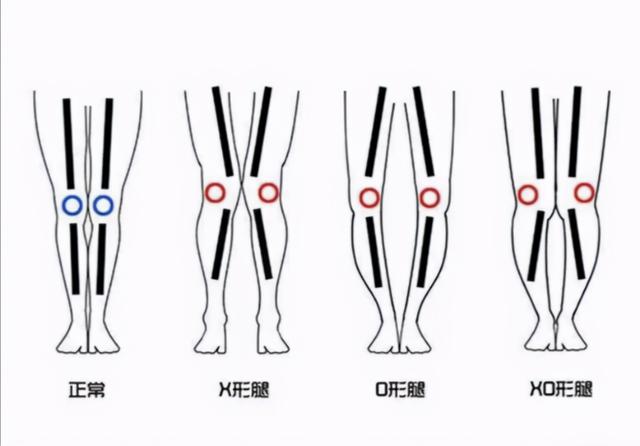 靴子的种类有哪些，靴子的种类有哪些英文（解析你的“腿型条件”）