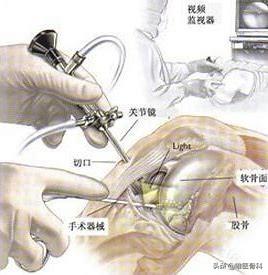 唯医骨科（骨科医生）