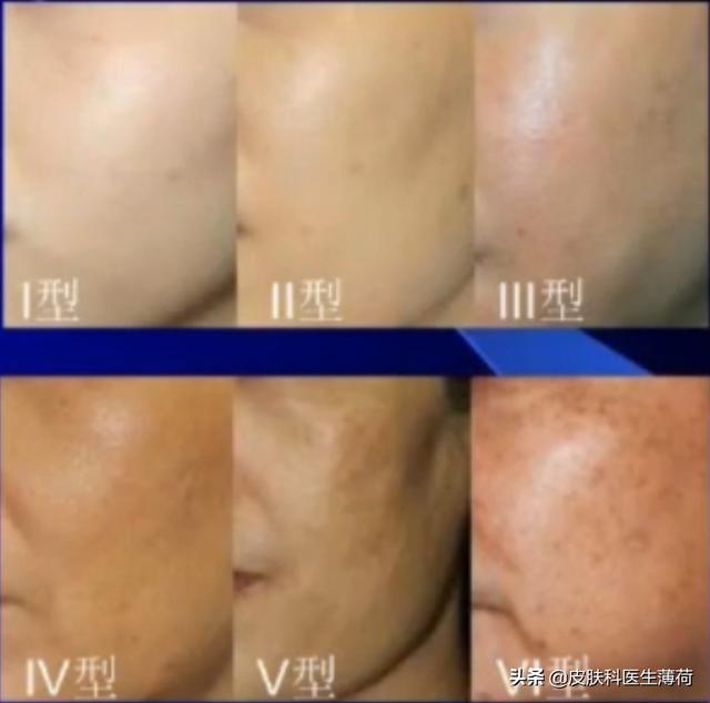 手臂上有咖啡色的斑图片，为何手臂上有很多暗沉的色斑（一文教你辨识自己长的究竟是啥斑）