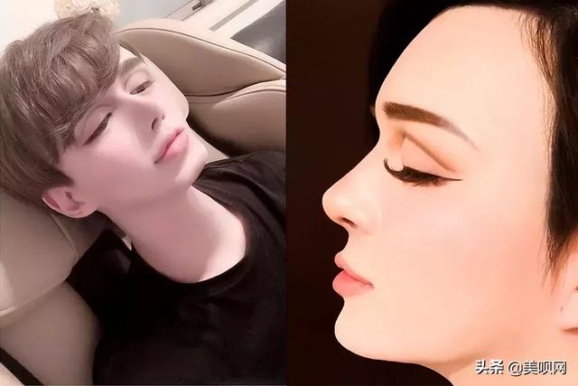刘梓晨面部填充，日本星二代突变刘梓晨同款“蛇精脸”