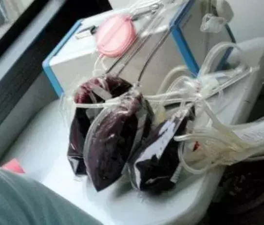 世界上有金色的血吗，全世界最珍贵的3大“黄金血”