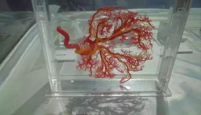 如何制作标本，如何栽种观音竹（那些好看、逼真的标本是如何制作的）