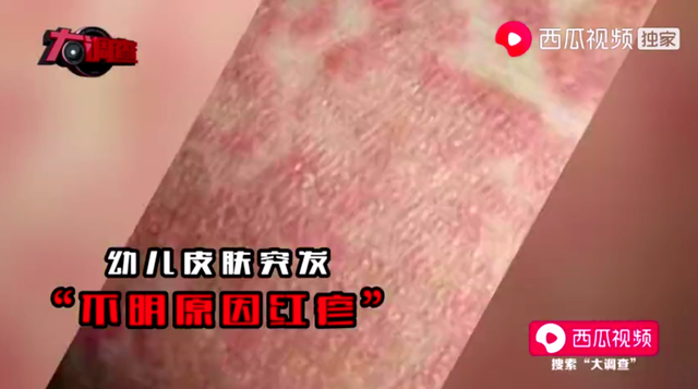 三鹿奶粉事件中存活的奶粉，12年后又现大头娃娃