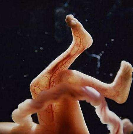 怀孕9周宝宝的样子图片