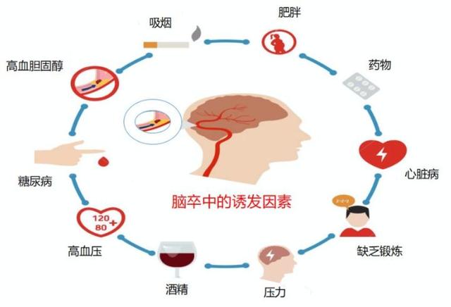 词语卒中的读音，卒中的读音（你可能一样都没搞清楚）